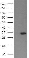 RARRES1 Antibody - HEK293T cells were transfected with the pCMV6-ENTRY control (Left lane) or pCMV6-ENTRY RARRES1 (Right lane) cDNA for 48 hrs and lysed. Equivalent amounts of cell lysates (5 ug per lane) were separated by SDS-PAGE and immunoblotted with anti-RARRES1.
