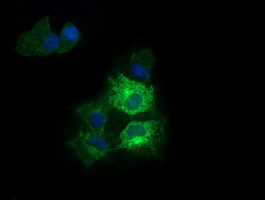 RARRES1 Antibody - Anti-RARRES1 mouse monoclonal antibody immunofluorescent staining of COS7 cells transiently transfected by pCMV6-ENTRY RARRES1.