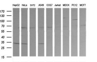 RARRES1 Antibody - Western blot of extracts (35ug) from 9 different cell lines by using anti-RARRES1 monoclonal antibody (HepG2: human; HeLa: human; SVT2: mouse; A549: human; COS7: monkey; Jurkat: human; MDCK: canine; PC12: rat; MCF7: human).