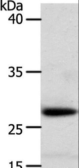 RARRES1 Antibody - Western blot analysis of Human liver cancer tissue, using RARRES1 Polyclonal Antibody at dilution of 1:300.