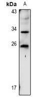 RARRES1 Antibody - Western blot analysis of TIG1 expression in HCT116 (A) whole cell lysates.