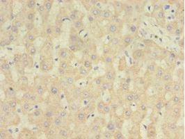 RARRES2 / Chemerin Antibody - Immunohistochemistry of paraffin-embedded human liver tissue using antibody at 1:100 dilution.  This image was taken for the unconjugated form of this product. Other forms have not been tested.