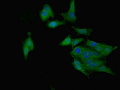 RARRES2 / Chemerin Antibody - Immunofluorescent analysis of Hela cells using RARRES2 Antibody at dilution of 1:100 and Alexa Fluor 488-congugated AffiniPure Goat Anti-Rabbit IgG(H+L)