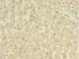 RARRES2 / Chemerin Antibody - Immunohistochemistry of paraffin-embedded human liver tissue using RARRES2 Antibody at dilution of 1:100