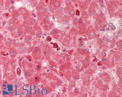 RARRES2 / Chemerin Antibody - Human Liver: Formalin-Fixed, Paraffin-Embedded (FFPE).  This image was taken for the unconjugated form of this product. Other forms have not been tested.