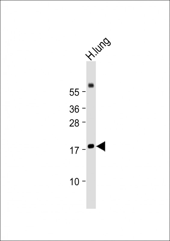 RARRES2 / Chemerin Antibody - Anti-RARRES2 Antibody (Center) at 1:2000 dilution + Human lung lysate Lysates/proteins at 20 µg per lane. Secondary Goat Anti-Rabbit IgG, (H+L), Peroxidase conjugated at 1/10000 dilution. Predicted band size: 19 kDa Blocking/Dilution buffer: 5% NFDM/TBST.