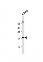 RARRES2 / Chemerin Antibody - Anti-RARRES2 Antibody (Center) at 1:2000 dilution + Human lung lysate Lysates/proteins at 20 µg per lane. Secondary Goat Anti-Rabbit IgG, (H+L), Peroxidase conjugated at 1/10000 dilution. Predicted band size: 19 kDa Blocking/Dilution buffer: 5% NFDM/TBST.