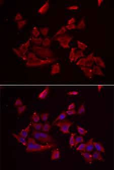 RARRES2 / Chemerin Antibody - Immunofluorescence analysis of MCF-7 cell using RARRES2 antibody. Blue: DAPI for nuclear staining.