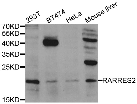 RARRES2 / Chemerin Antibody - Western blot analysis using RARRES2 antibody
