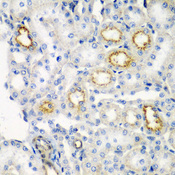 RARRES2 / Chemerin Antibody - Immunohistochemistry of paraffin-embedded rat kidney tissue.