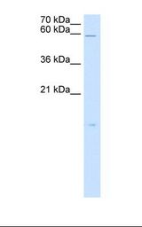 RARRES3 Antibody - HepG2 cell lysate. Antibody concentration: 5.0 ug/ml. Gel concentration: 15%.  This image was taken for the unconjugated form of this product. Other forms have not been tested.