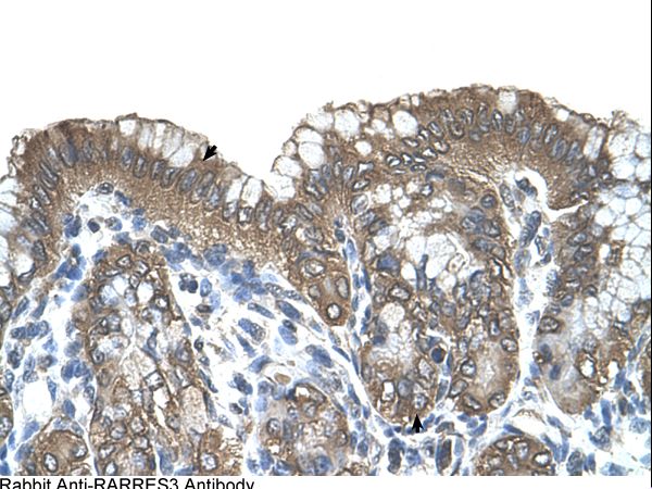 RARRES3 Antibody - RARRES3 antibody RARRES3(retinoic acid receptor responder (tazarotene induced) 3) Antibody was used in IHC to stain formalin-fixed, paraffin-embedded human stomach.  This image was taken for the unconjugated form of this product. Other forms have not been tested.