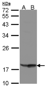 RARRES3 Antibody - Sample (30 ug of whole cell lysate). A: Raji, B: MOLT4. 12% SDS PAGE. RARRES3 / RIG1 antibody diluted at 1:1000
