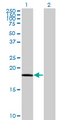 RARRES3 Antibody - Western Blot analysis of RARRES3 expression in transfected 293T cell line by RARRES3 monoclonal antibody (M10), clone 1H5.Lane 1: RARRES3 transfected lysate(18.2 KDa).Lane 2: Non-transfected lysate.