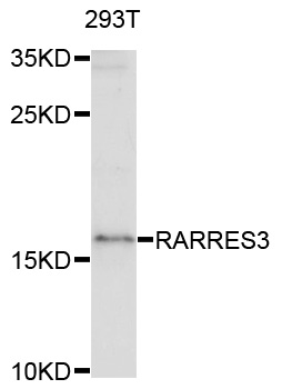 RARRES3 Antibody - Western blot analysis of extracts of 293T cells.