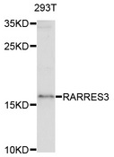 RARRES3 Antibody - Western blot analysis of extracts of 293T cells.