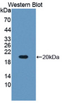 RARS Antibody - Western blot of RARS antibody.