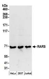 RARS Antibody - Detection of human RARS by western blot. Samples: Whole cell lysate (50 µg) from HeLa, HEK293T, and Jurkat cells prepared using NETN lysis buffer. Antibodies: Affinity purified rabbit anti-RARS antibody used for WB at 0.1 µg/ml. Detection: Chemiluminescence with an exposure time of 30 seconds.