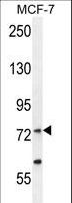 RARS Antibody - RARS Antibody western blot of MCF-7 cell line lysates (35 ug/lane). The RARS antibody detected the RARS protein (arrow).