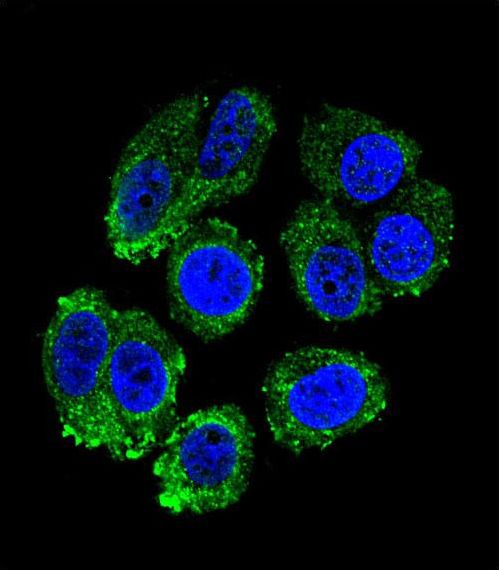 RARS Antibody - Confocal immunofluorescence of RARS Antibody with MCF-7 cell followed by Alexa Fluor 488-conjugated goat anti-rabbit lgG (green). DAPI was used to stain the cell nuclear (blue).