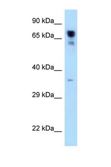 RARS Antibody - RARS antibody Western blot of 721_B Cell lysate. Antibody concentration 1 ug/ml.  This image was taken for the unconjugated form of this product. Other forms have not been tested.