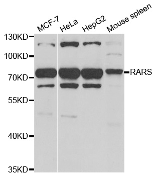 RARS Antibody - Western blot analysis of extracts of various cell lines.