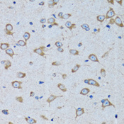 RARS Antibody - Immunohistochemistry of paraffin-embedded rat brain tissue.