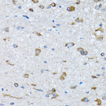 RARS Antibody - Immunohistochemistry of paraffin-embedded mouse spinal cord tissue.