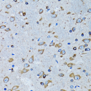 RARS Antibody - Immunohistochemistry of paraffin-embedded mouse brain tissue.