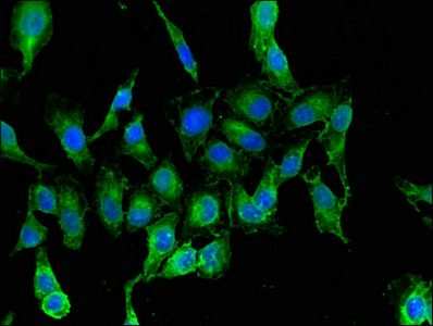 RARS Antibody - Immunofluorescent analysis of Hela cells using RARS Antibody at dilution of 1:100 and Alexa Fluor 488-congugated AffiniPure Goat Anti-Rabbit IgG(H+L)