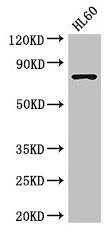 RARS Antibody - Western Blot Positive WB detected in: HL60 whole cell lysate, K562 whole cell lysate, A549 whole cell lysate All lanes: RARS antibody at 3.5µg/ml Secondary Goat polyclonal to rabbit IgG at 1/50000 dilution Predicted band size: 76, 68 kDa Observed band size: 76, 68 kDa