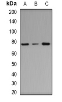 RARS Antibody - Western blot analysis of ArgRS expression in HeLa (A); HepG2 (B); mouse spleen (C) whole cell lysates.