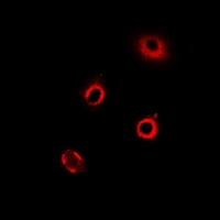 RARS Antibody - Immunofluorescent analysis of ArgRS staining in MCF7 cells. Formalin-fixed cells were permeabilized with 0.1% Triton X-100 in TBS for 5-10 minutes and blocked with 3% BSA-PBS for 30 minutes at room temperature. Cells were probed with the primary antibody in 3% BSA-PBS and incubated overnight at 4 deg C in a humidified chamber. Cells were washed with PBST and incubated with a DyLight 594-conjugated secondary antibody (red) in PBS at room temperature in the dark.