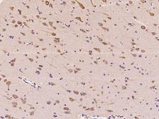 RARS Antibody - Immunochemical staining of human RARS in human brain with rabbit polyclonal antibody at 1:100 dilution, formalin-fixed paraffin embedded sections.