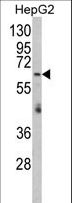 RARS2 / ARGRS Antibody - Western blot of RARS2 Antibody in HepG2 cell line lysates (35 ug/lane). RARS2 (arrow) was detected using the purified antibody.