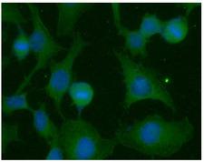 Ras Tag Antibody - ICC/IF analysis of RAS in HeLa cells line, stained with DAPI (Blue) for nucleus staining and monoclonal anti-human RAS antibody (1:100) with goat anti-mouse IgG-Alexa fluor 488 conjugate (Green).