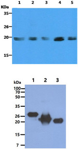 Ras Tag Antibody - The Cell lysates (40ug) were resolved by SDS-PAGE, transferred to PVDF membrane and probed with anti-human KRAS antibody (1:500). Proteins were visualized using a goat anti-mouse secondary antibody conjugated to HRP and an ECL detection system. Lane 1. : HeLa cell lysate Lane 2. : HepG2 cell lysate Lane 3. : Ramos cell lysate Lane 4. : A549 cell lysate Lane 5. : Balb/3T3 cell lysate The Recombinant protein (100ng) were resolved by SDS-PAGE, transferred to PVDF membrane and probed with anti-human RAS antibody (1:1000). Proteins were visualized using a goat anti-mouse secondary antibody conjugated to HRP and an ECL detection system. Lane 1. : KRAS recombinant protein (ATGP2062) Lane 2. : HRAS recombinant protein (ATGP0516) Lane 3. : NRAS recombinant protein (ATGP0492)