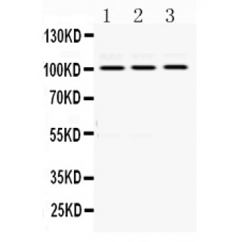 RASA1 Antibody - RASA1 antibody Western blot. All lanes: Anti RASA1 at 0.5 ug/ml. Lane 1: HELA Whole Cell Lysate at 40 ug. Lane 2: MCF-7 Whole Cell Lysate at 40 ug. Lane 3: SMMC Whole Cell Lysate at 40 ug. Predicted band size: 100 kD. Observed band size: 100 kD.