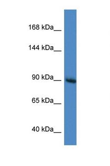RASA1 Antibody - RASA1 antibody Western blot of Mouse Brain lysate. Antibody concentration 1 ug/ml. This image was taken for the unconjugated form of this product. Other forms have not been tested.