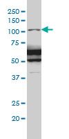 RASA1 Antibody - RASA1 monoclonal antibody (M01), clone 2C12 Western blot of RASA1 expression in IMR-32.