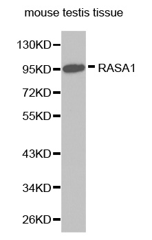 RASA1 Antibody - Western blot analysis of extracts of mouse testis tissue, using RASA1 antibody.