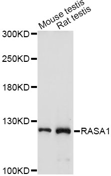 RASA1 Antibody - Western blot analysis of extracts of various cell lines, using RASA1 antibody at 1:1000 dilution. The secondary antibody used was an HRP Goat Anti-Rabbit IgG (H+L) at 1:10000 dilution. Lysates were loaded 25ug per lane and 3% nonfat dry milk in TBST was used for blocking. An ECL Kit was used for detection and the exposure time was 30s.
