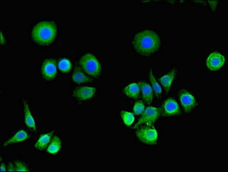 RASA1 Antibody - Immunofluorescent analysis of PC-3 cells using RASA1 Antibody at dilution of 1:100 and Alexa Fluor 488-congugated AffiniPure Goat Anti-Rabbit IgG(H+L)