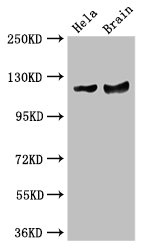 RASA1 Antibody - Western Blot Positive WB detected in: Hela whole cell lysate, Mouse brain tissue All lanes: RASA1 antibody at 3.5µg/ml Secondary Goat polyclonal to rabbit IgG at 1/50000 dilution Predicted band size: 117, 101, 59, 102 kDa Observed band size: 117 kDa