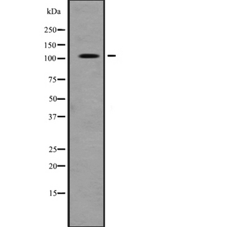 RASA1 Antibody - Western blot analysis of RASA1 expression in HeLa cells lysate. The lane on the left is treated with the antigen-specific peptide.