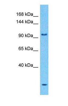 RASA1 Antibody - Western blot of RASA1 Antibody with human Fetal Lung lysate.  This image was taken for the unconjugated form of this product. Other forms have not been tested.