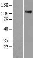 RASA1 Protein - Western validation with an anti-DDK antibody * L: Control HEK293 lysate R: Over-expression lysate