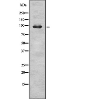 RASA2 Antibody - Western blot analysis of RASA2 expression in HEK293 cells. The lane on the left is treated with the antigen-specific peptide.