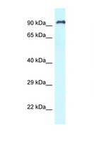 RASAL1 / RASAL Antibody - RASAL1 antibody Western blot of Jurkat Cell lysate. Antibody concentration 1 ug/ml.  This image was taken for the unconjugated form of this product. Other forms have not been tested.