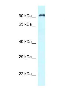 RASAL1 / RASAL Antibody - RASAL1 antibody Western blot of Jurkat Cell lysate. Antibody concentration 1 ug/ml.  This image was taken for the unconjugated form of this product. Other forms have not been tested.